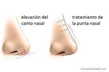 Images_131398_thumb_1