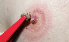 Images_131454_thumb_1