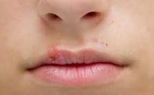 Images_57949_thumb_17