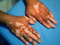 Images_84422_thumb_32